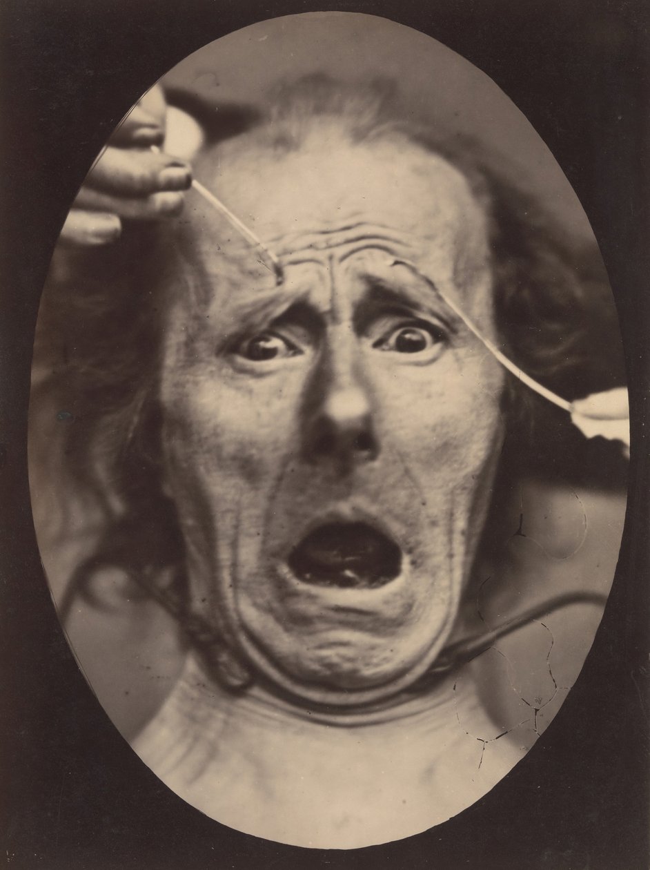 Electro-Physiologie, 64. ábra, 1854-56, nyomtatva 1862. alkotó: Adrien Alban Tournachon