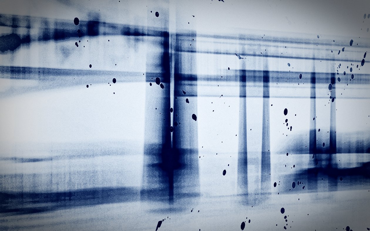 Snow (röntgen), 2019, (fényképezés) alkotó: Alex Caminker