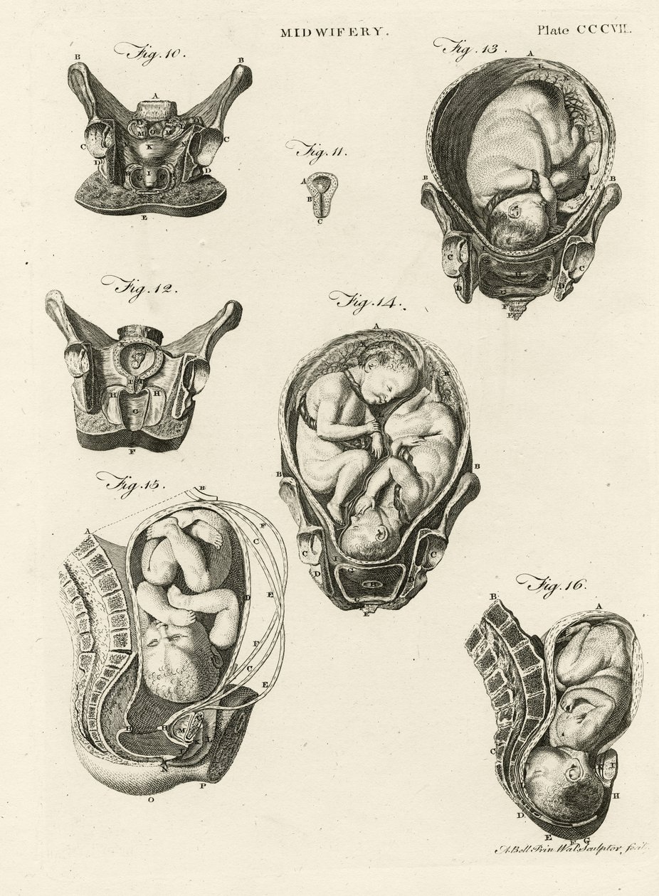 Szülésznő, illusztráció az "Encyclopedia Britannica"-ból, kiadva Edinburgh-ban, 1798 (rézmetszet) alkotó: Alexander Bell