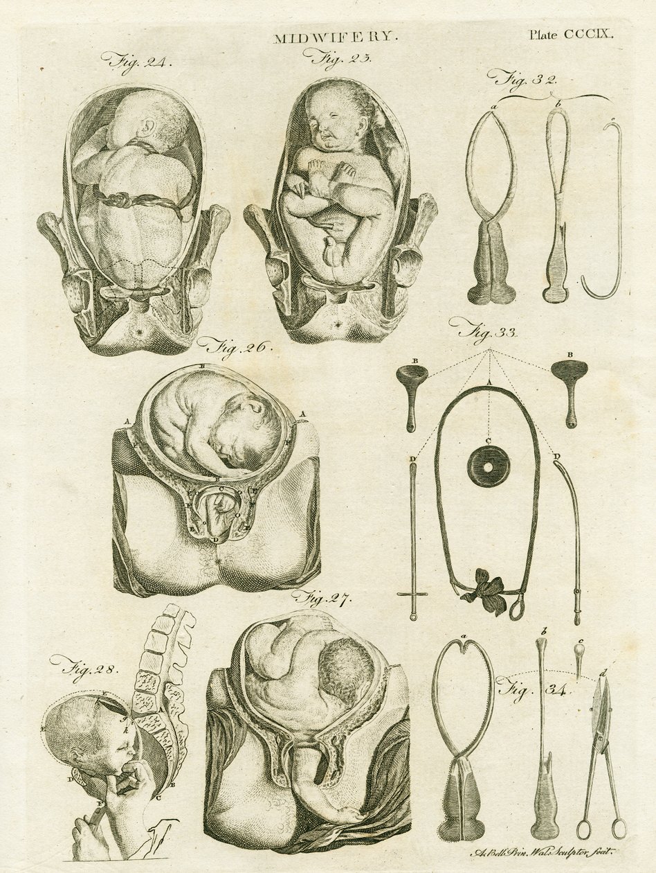 Szülésznő, illusztráció az "Encyclopedia Britannica"-ból, kiadva Edinburgh-ban, 1798 (rézmetszet) alkotó: Alexander Bell