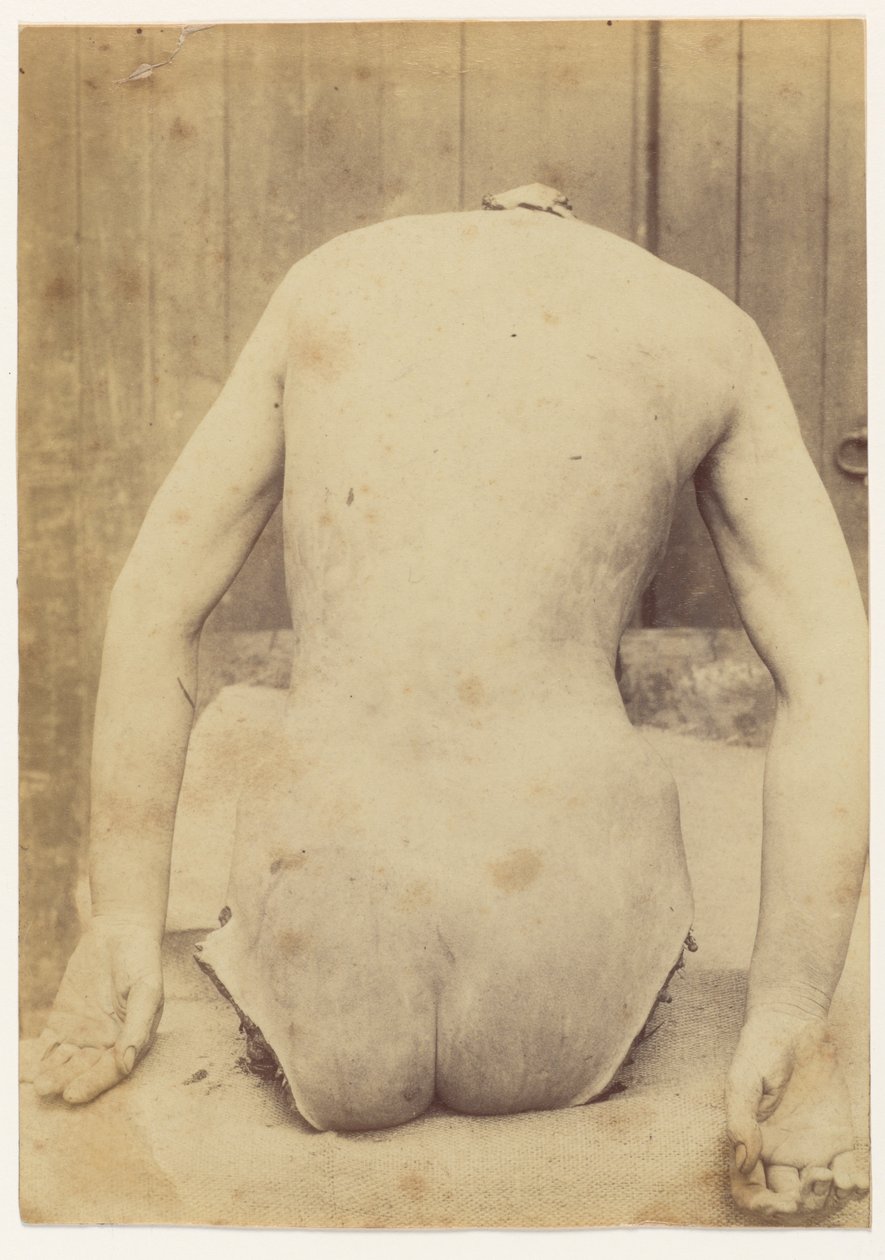 A csomagtartó hátsó nézete alkotó: Alphonse Bertillon