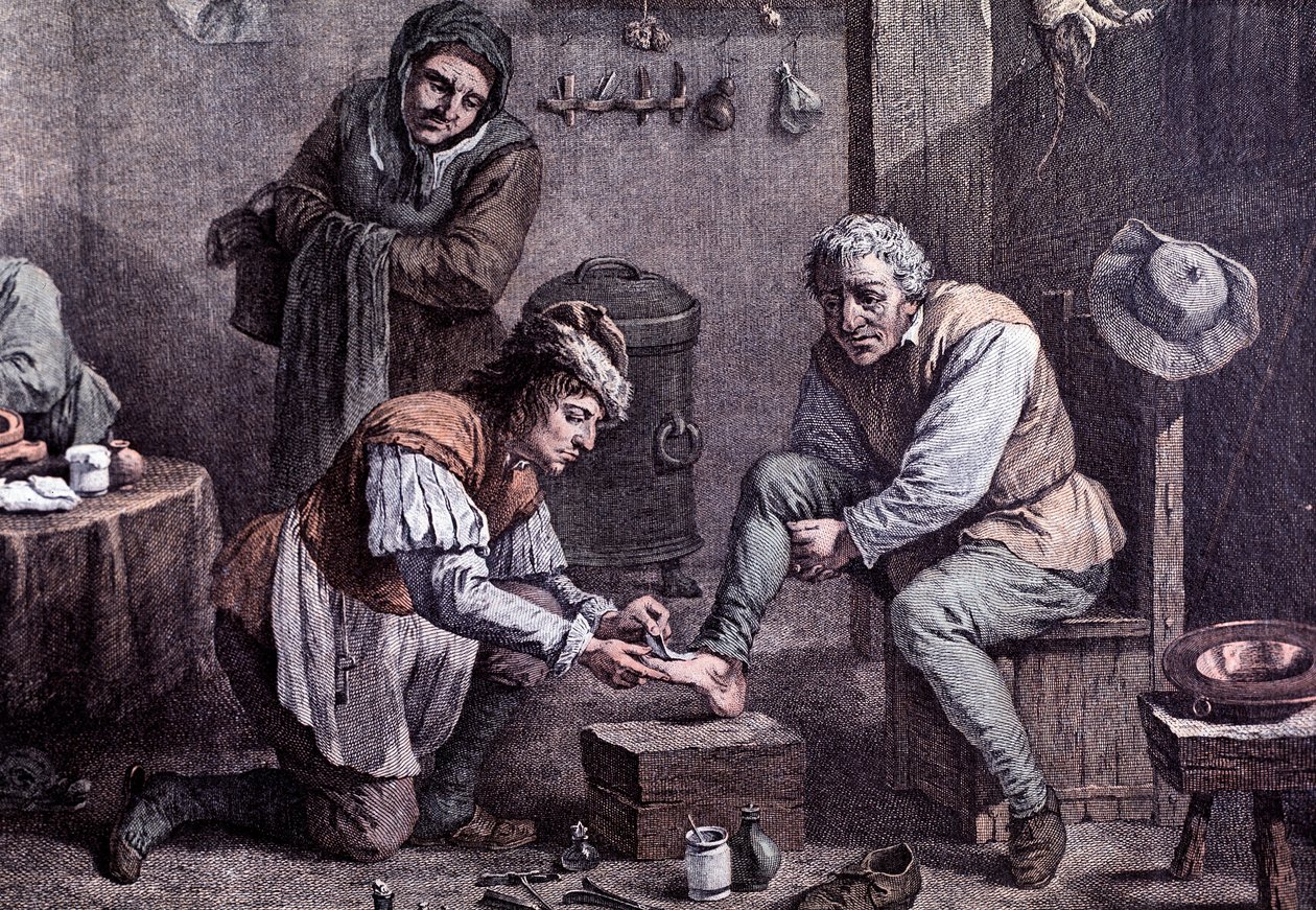 Sebészeti műtét (gravírozás alkotó: Anonymous Anonymous