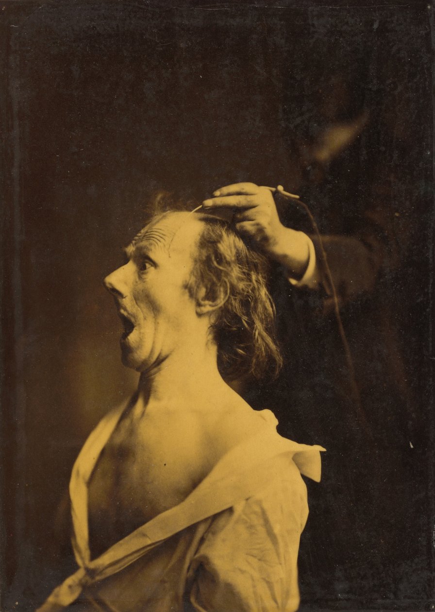 Döbbenet, döbbenet, ámulat, 1854-1856, nyomtatva 1862. alkotó: Duchenne de Boulogne