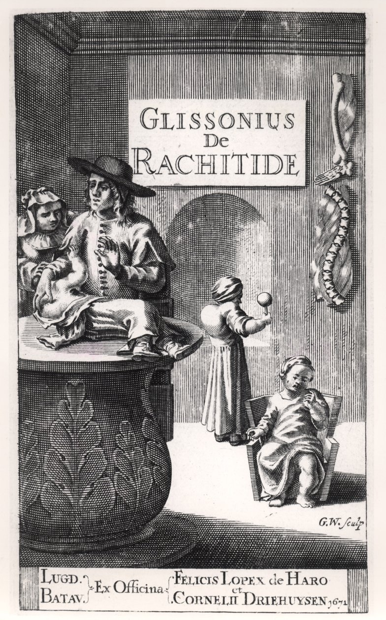 Francis Glisson (1597-1677) Leidenben, 1671-ben jelent meg alkotó: Dutch School