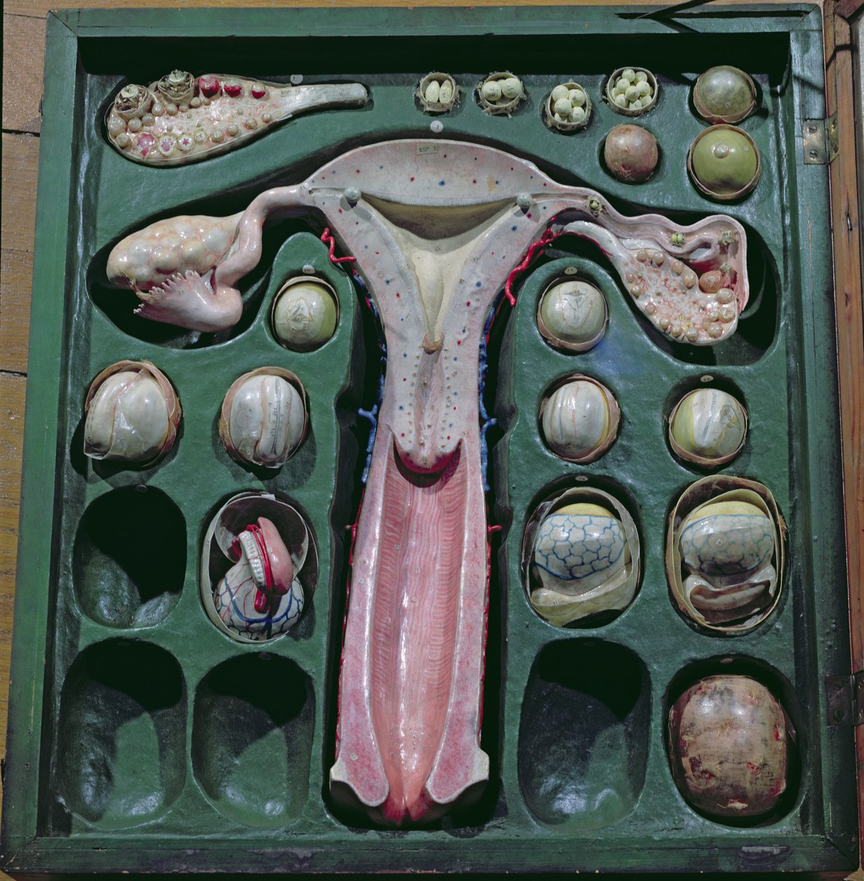 Női nemi szervek, c. 1830 (festett karton) alkotó: French School