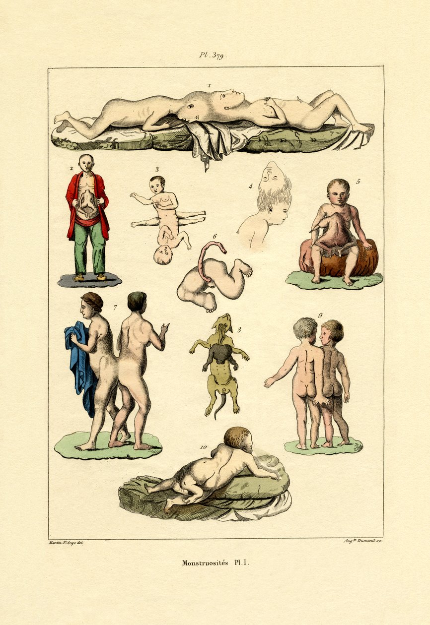 Freak, 1833-39 alkotó: French School