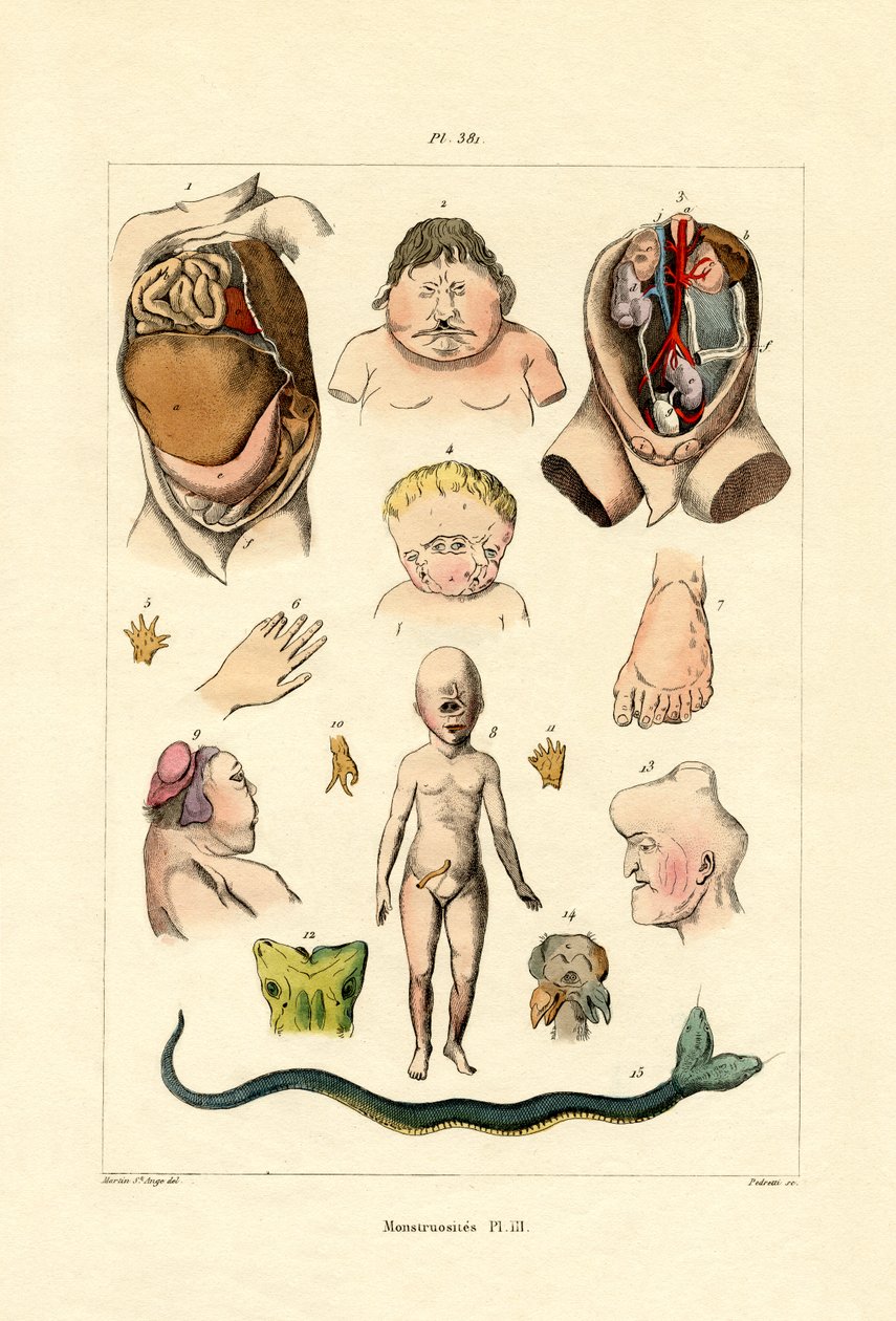 Freak, 1833-39 alkotó: French School