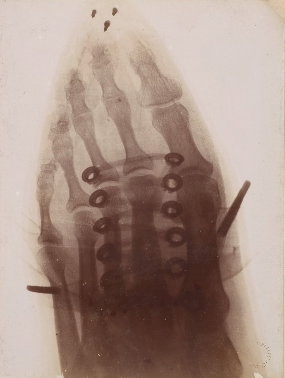 A láb a cipőn keresztül, 1896. alkotó: Henri van Heurck