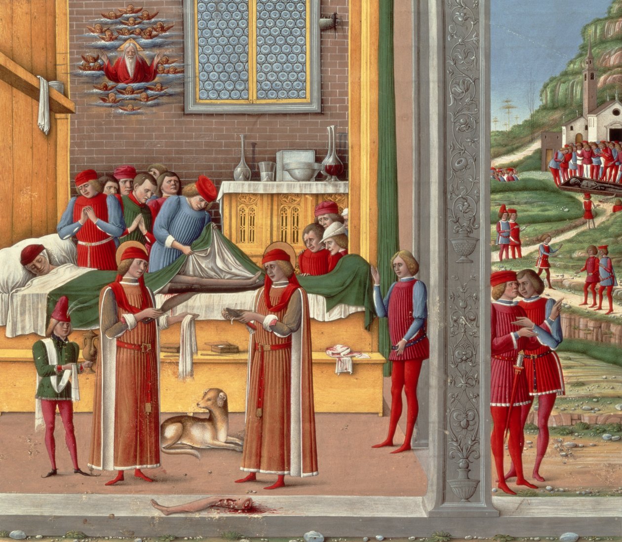 Középkori amputációs jelenet (tempera a panelen) alkotó: Italian School