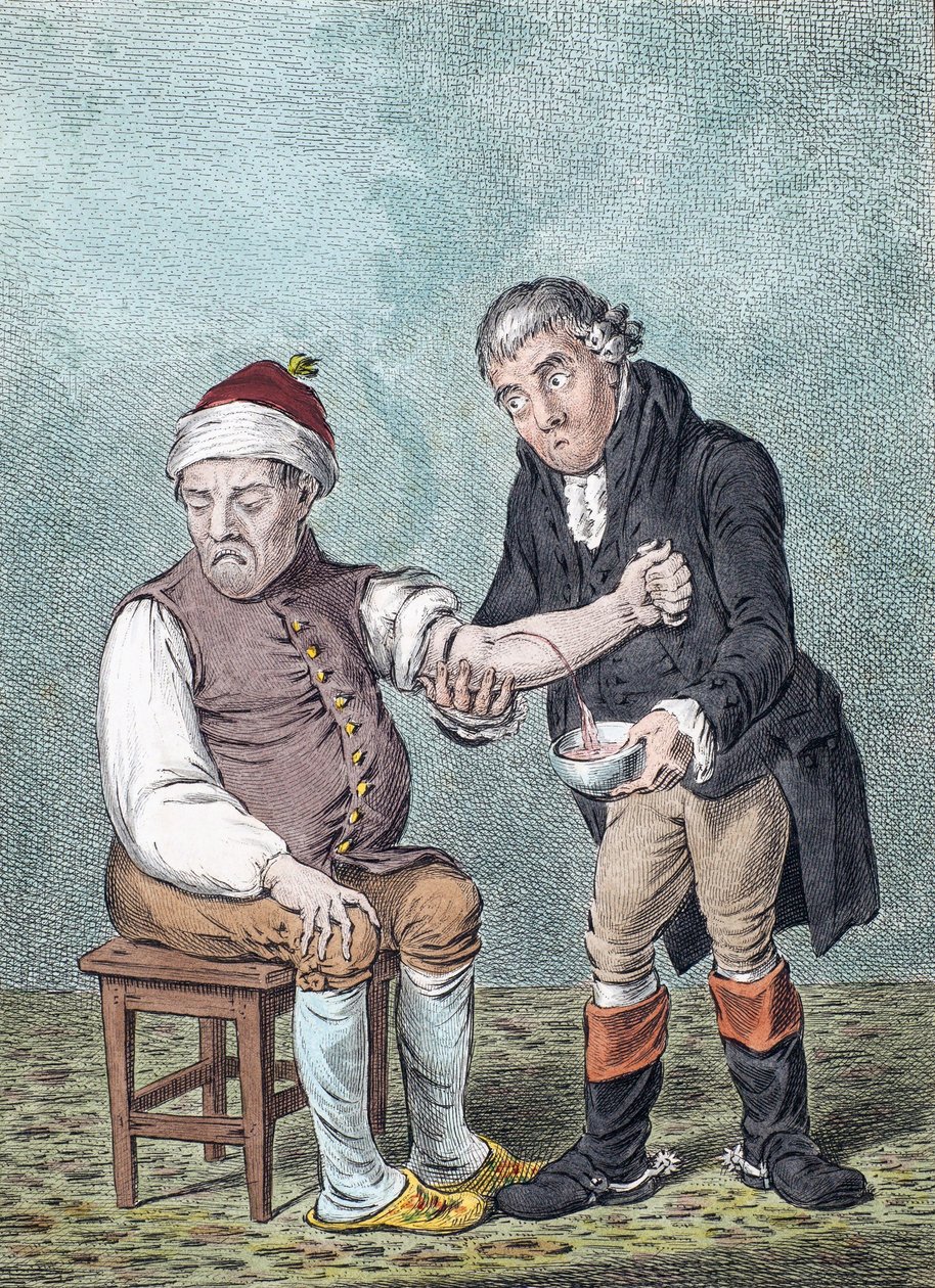 Köpölyözés. Köpölyözés. (nyomtatás) alkotó: James (after) Gillray