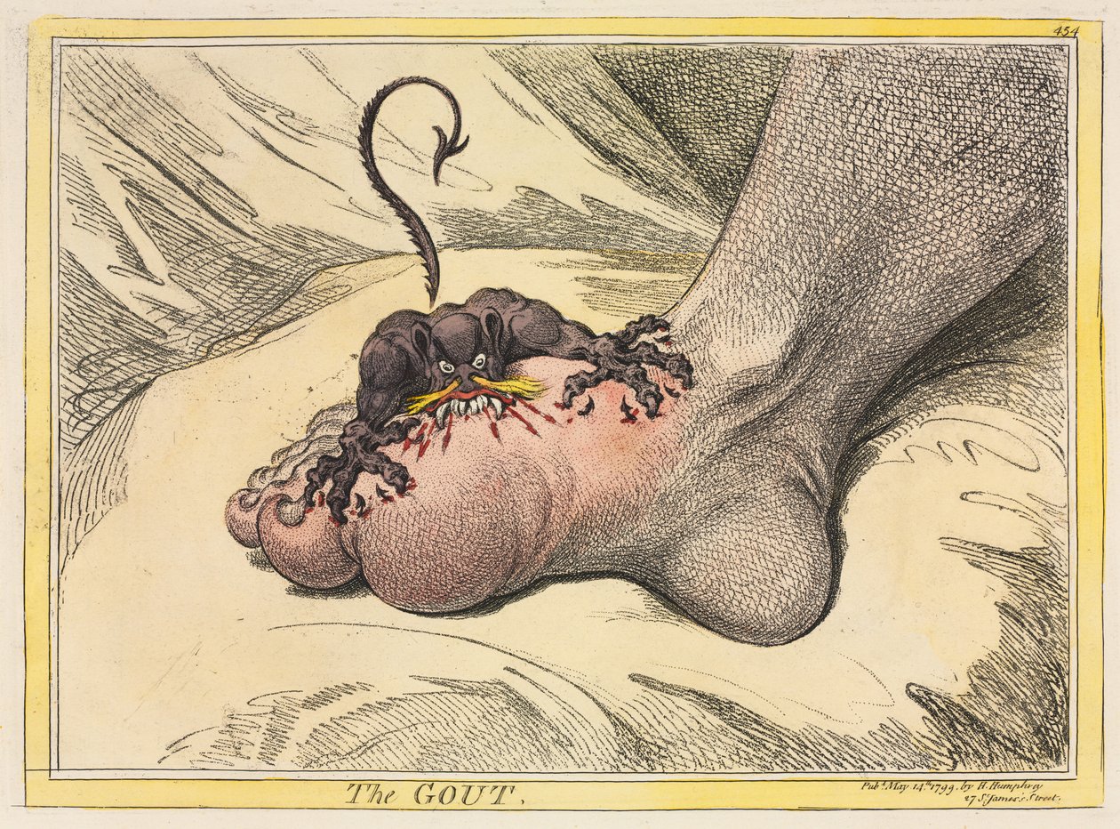 A köszvény, 1799. alkotó: James Gillray