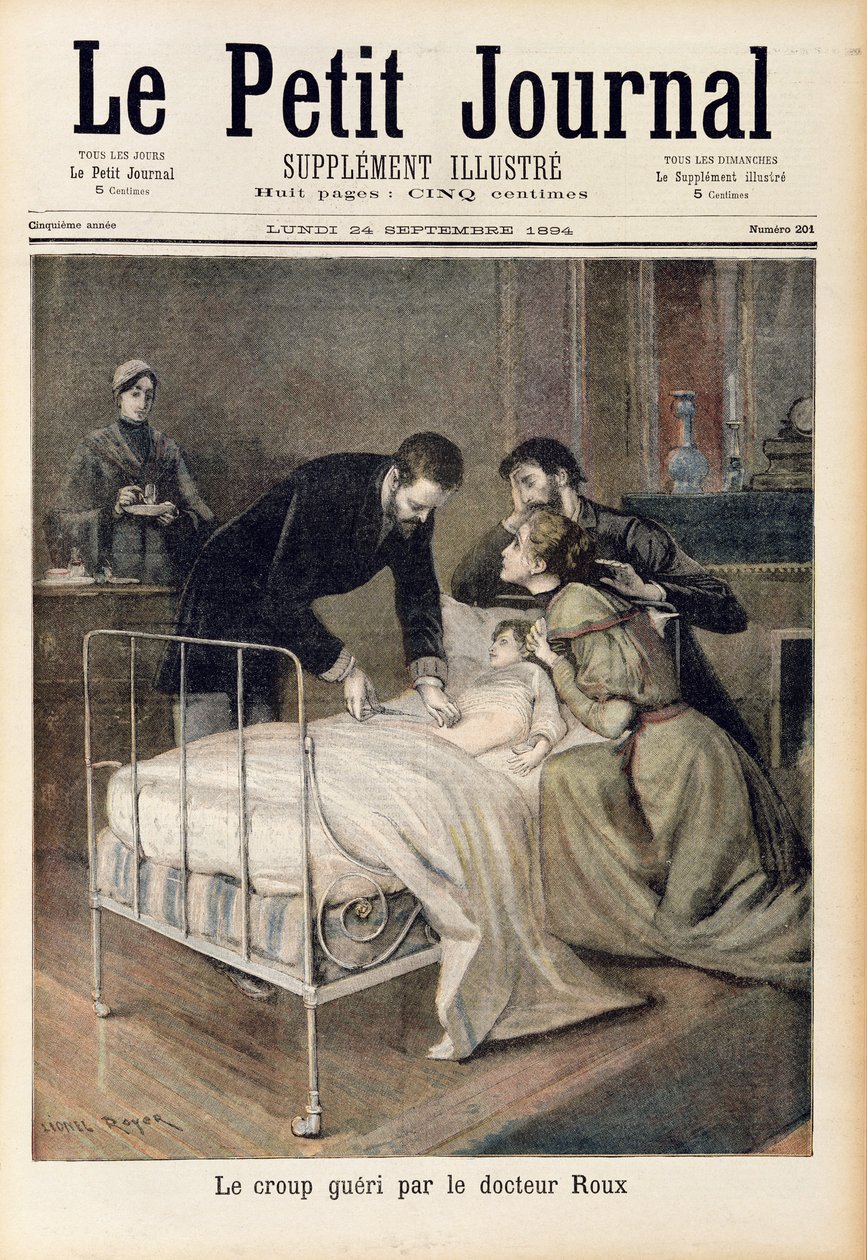 Doktor Roux által meggyógyított csonk, illusztráció a „Le Petit Journal”-ból, 1894. szeptember 24. alkotó: Lionel Royer