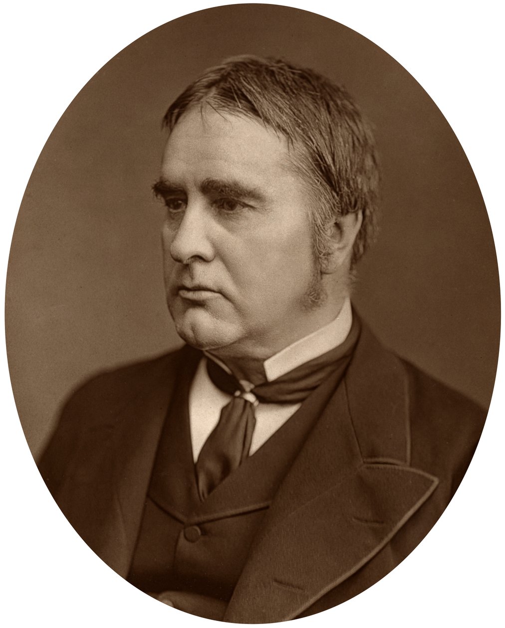 Sir William Withey Gull, 1878. alkotó: Lock and Whitfield