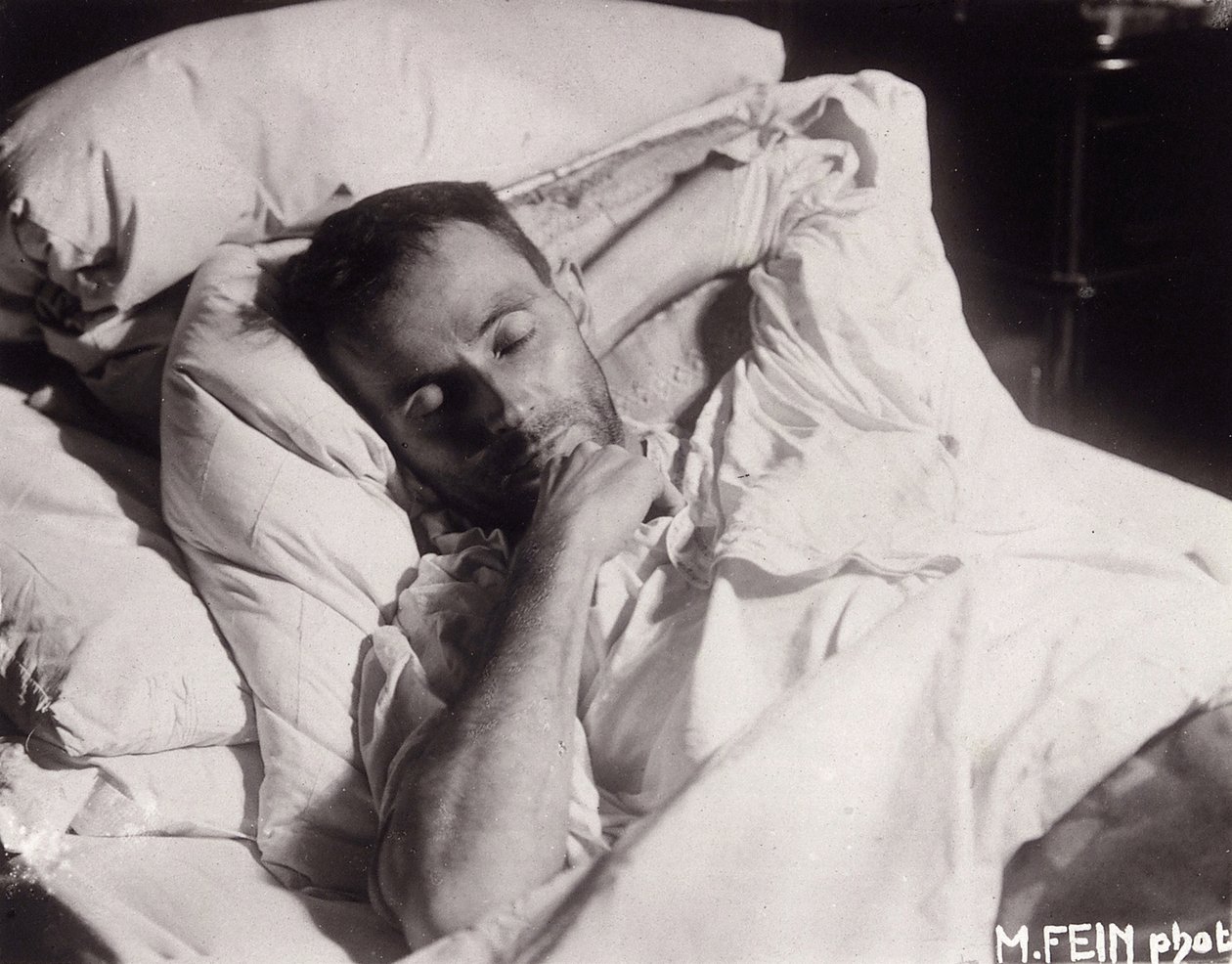 Egon Schiele a halálos ágyán, 1918. alkotó: Martha Fein