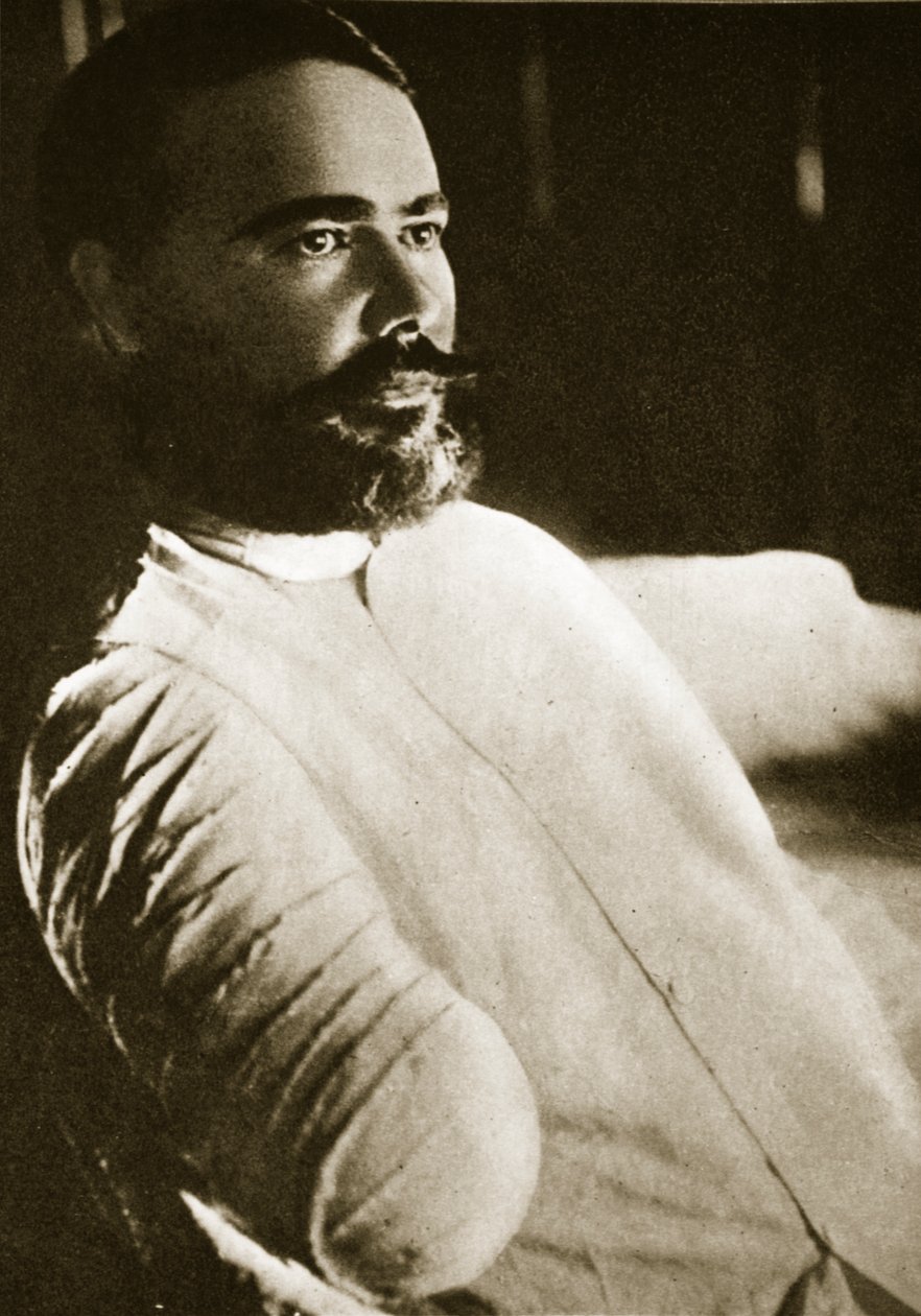 Obregon tábornok, miután Santa Ana del Conde-nál egy gránát lerobbantotta a jobb karját, 1915 alkotó: Paul Thompson