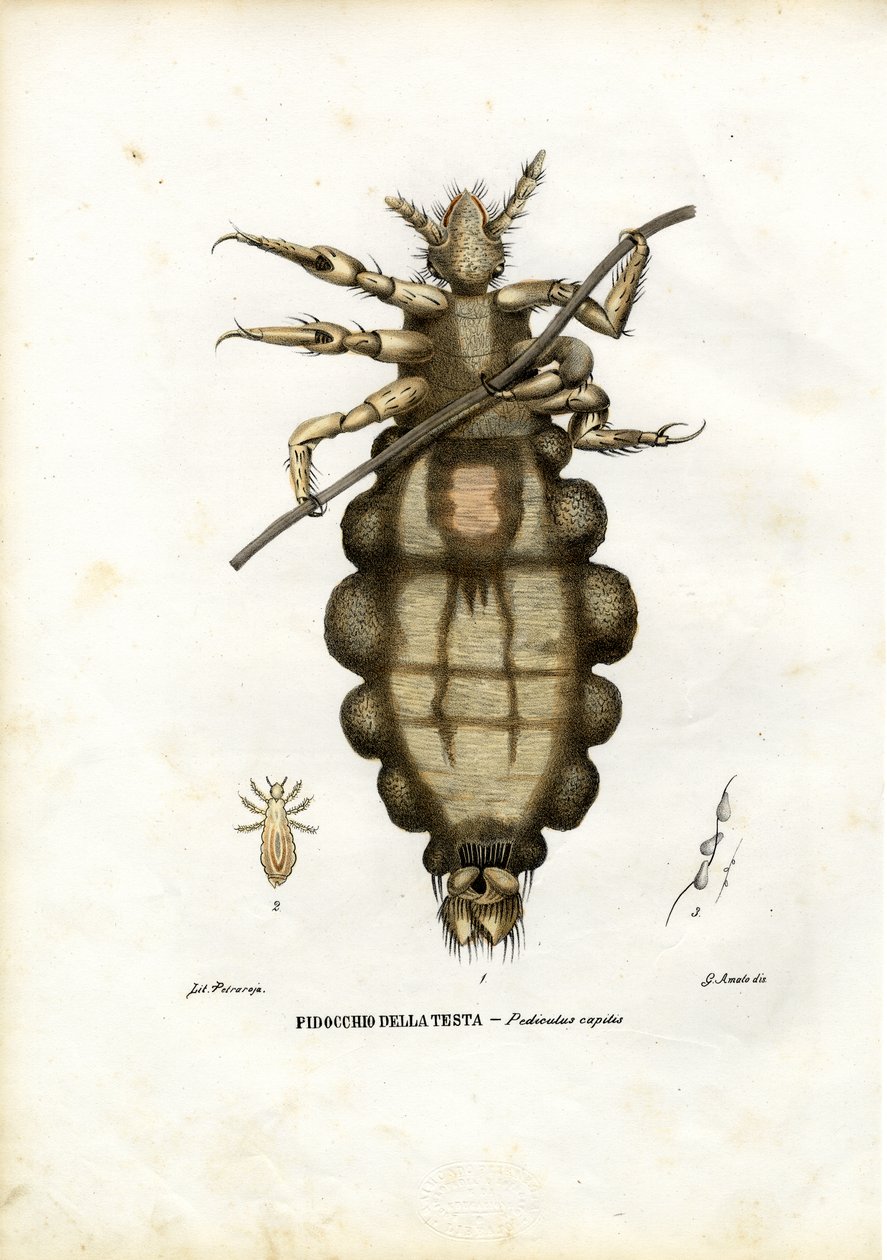 Tetű, 1863-79 alkotó: Raimundo Petraroja