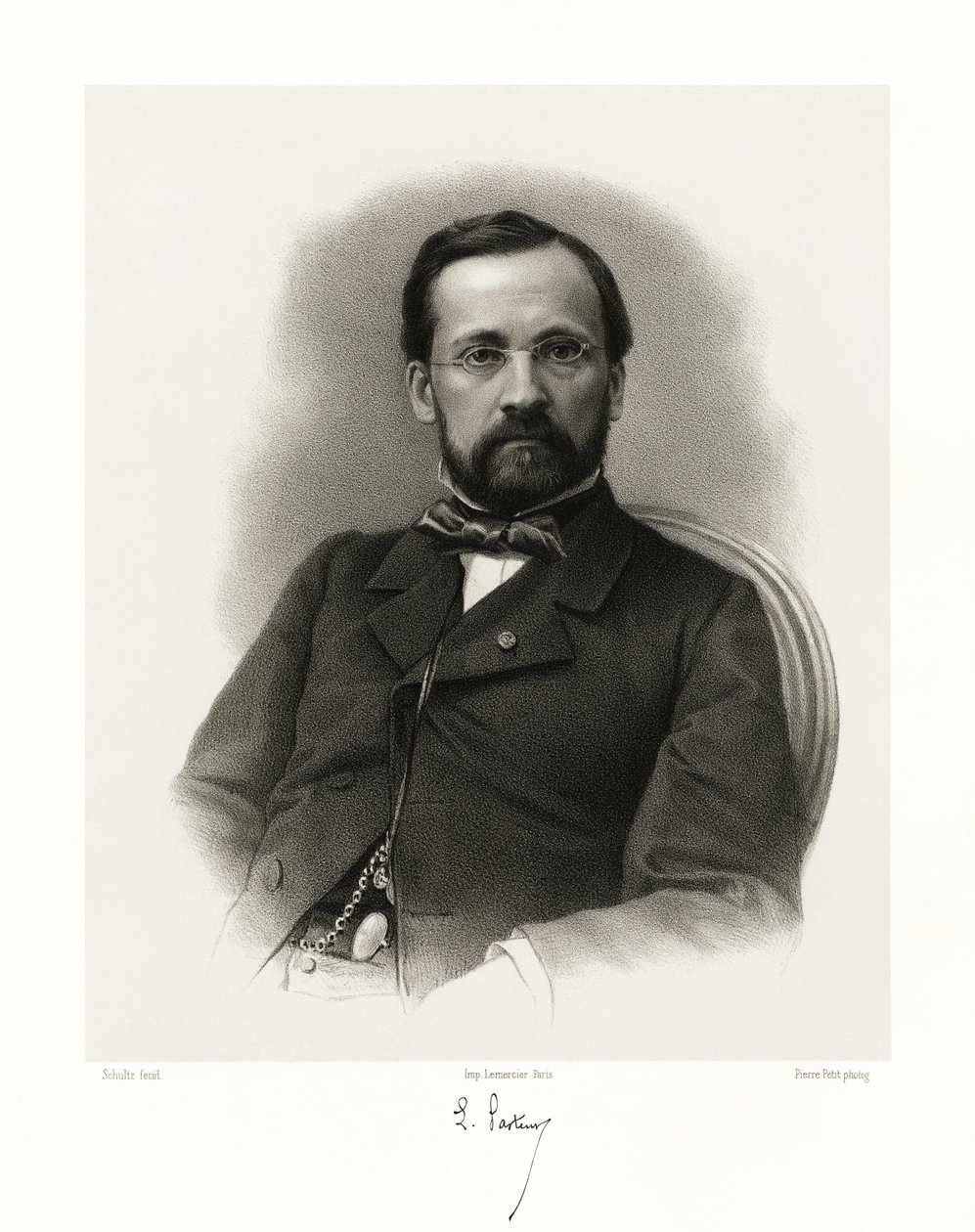 Louis Pasteur, 1865-66 alkotó: Schultz