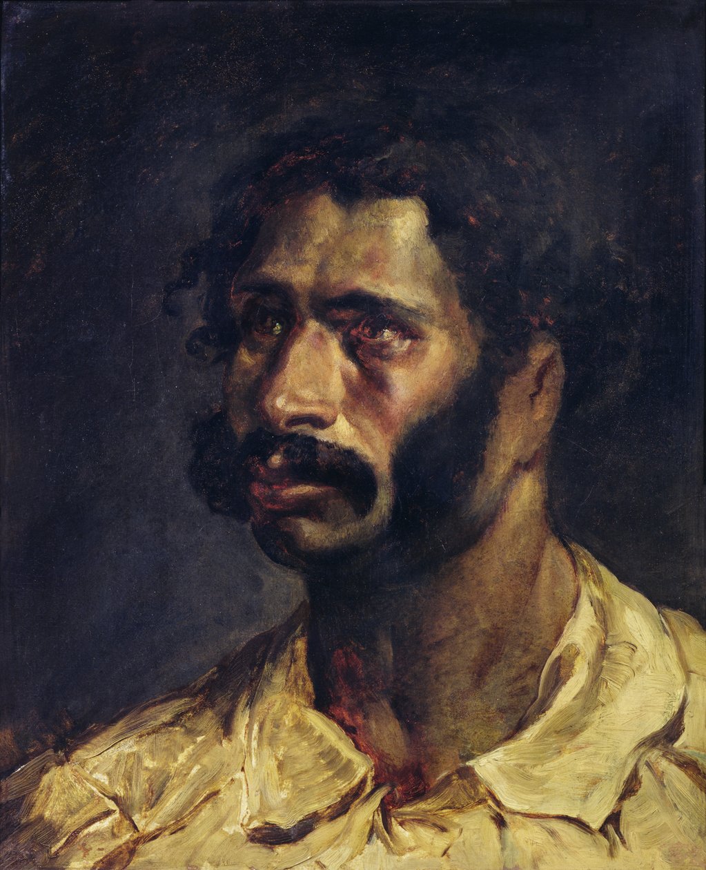 „A Medúza” ácsának portréja, 1812 körül alkotó: Theodore Gericault