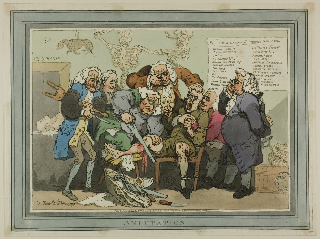 Amputálás alkotó: Thomas Rowlandson