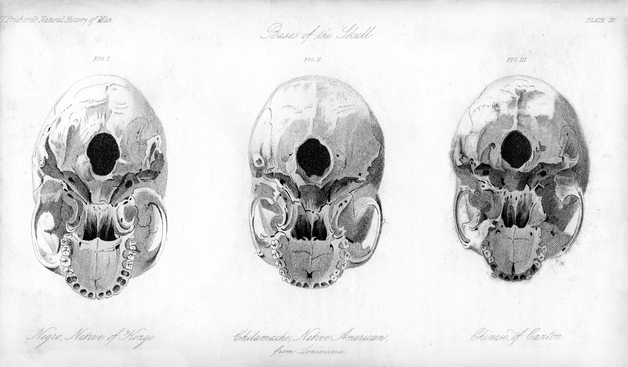 A koponya alapja, 1848 alkotó: Unbekannt