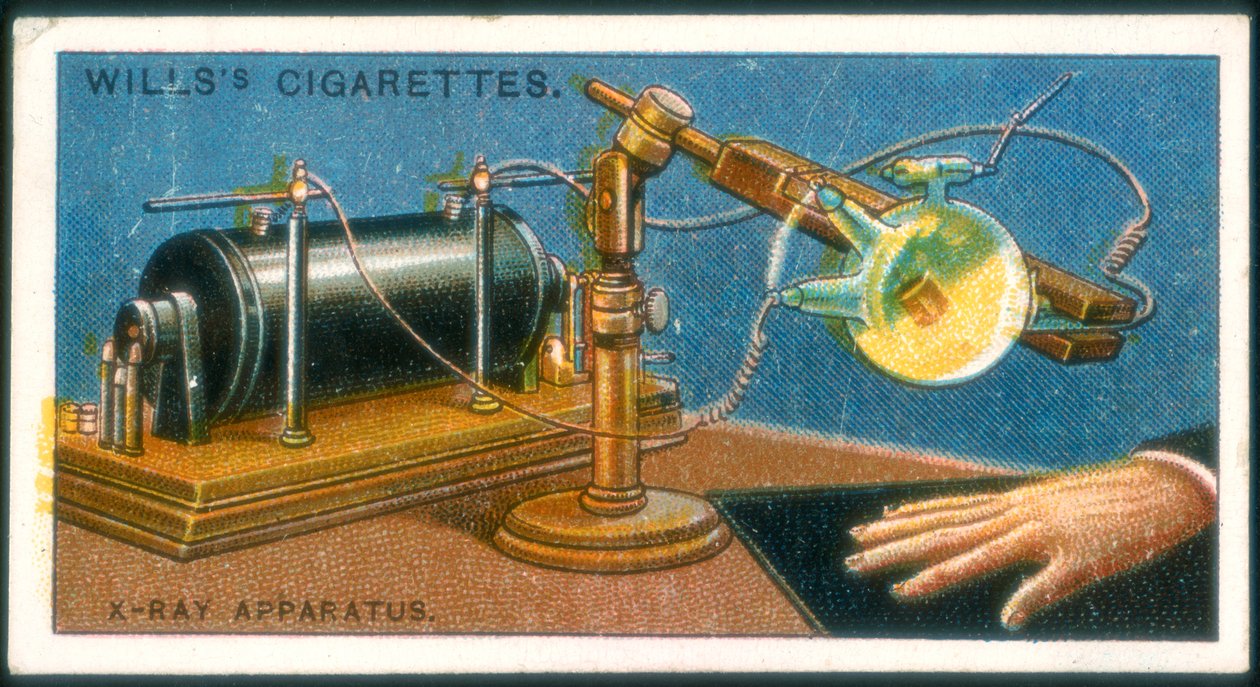 Röntgenkészülék, 1915 alkotó: Unbekannt