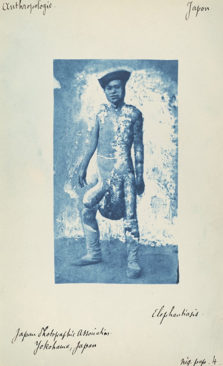 Vastagbőrűség alkotó: Unknown 19th Century