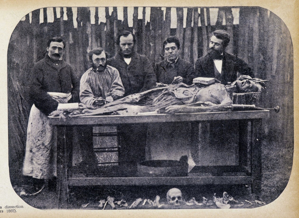 Boncolás, v.1865. alkotó: Unknown photographer