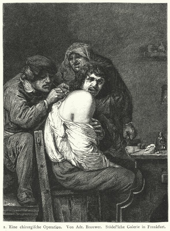 A hátsó művelet alkotó: Adriaen (after) Brouwer
