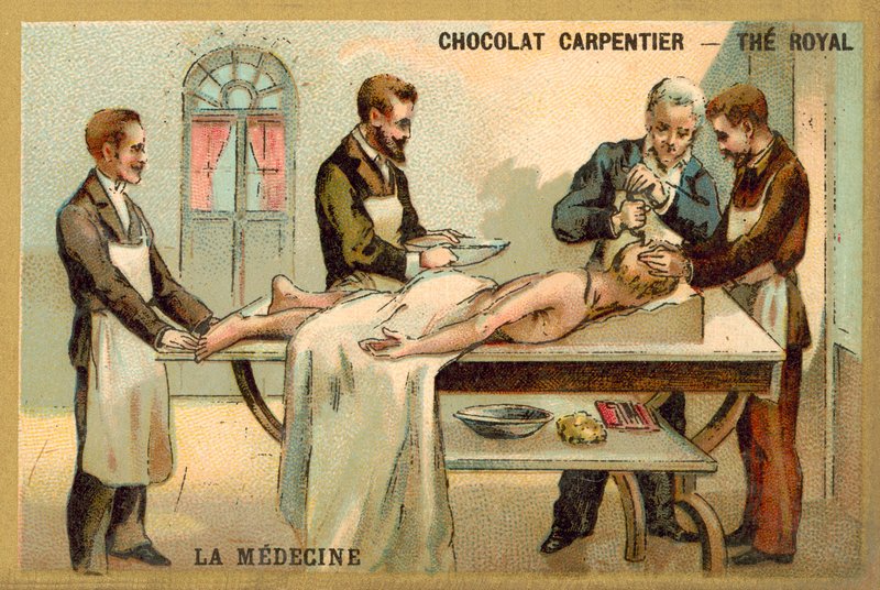 Trepanning (chromolitho) alkotó: French School