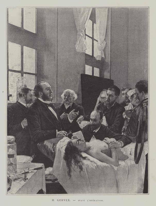 Avant lOperation (a művelet előtt) alkotó: Henri Gervex